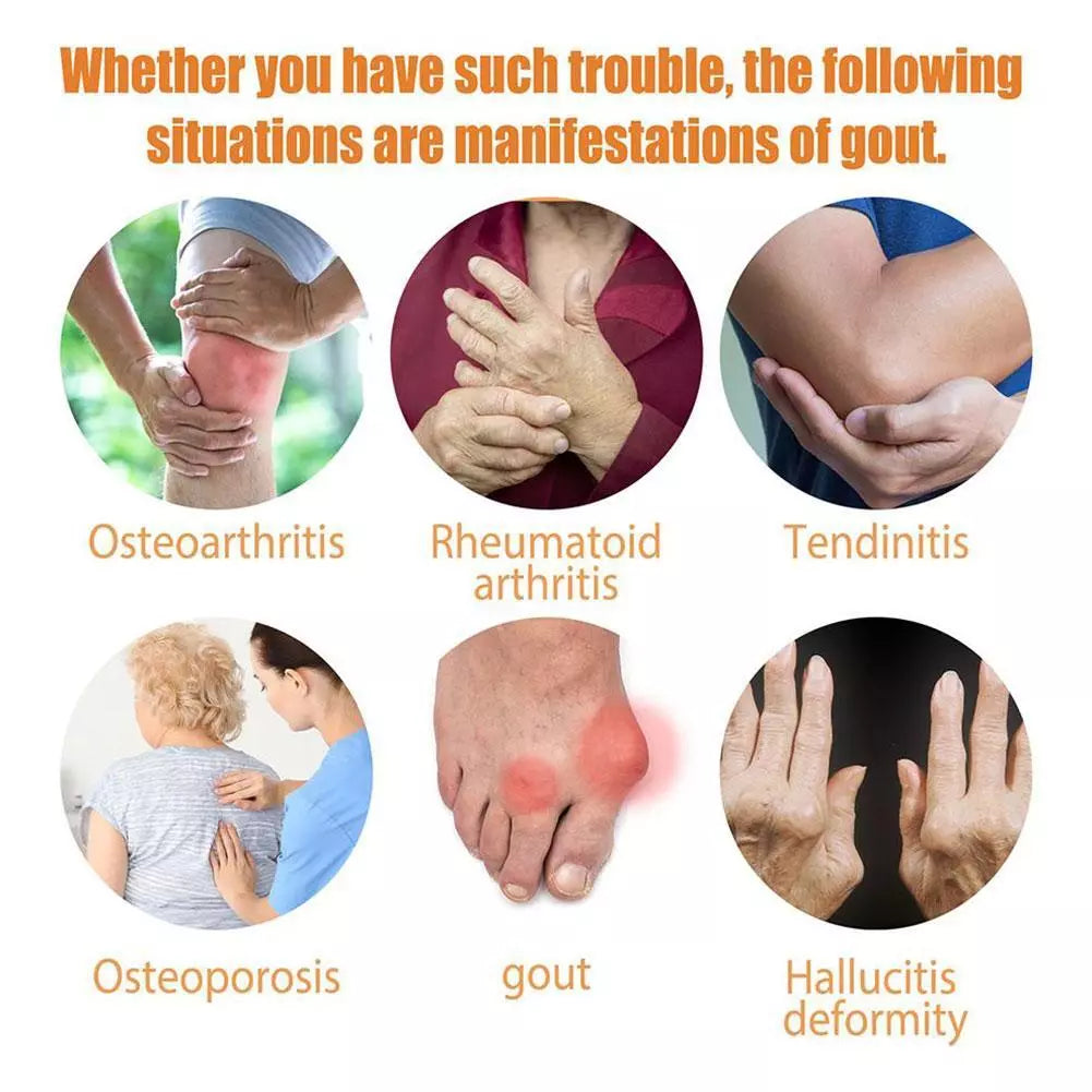 Gout treatment spray