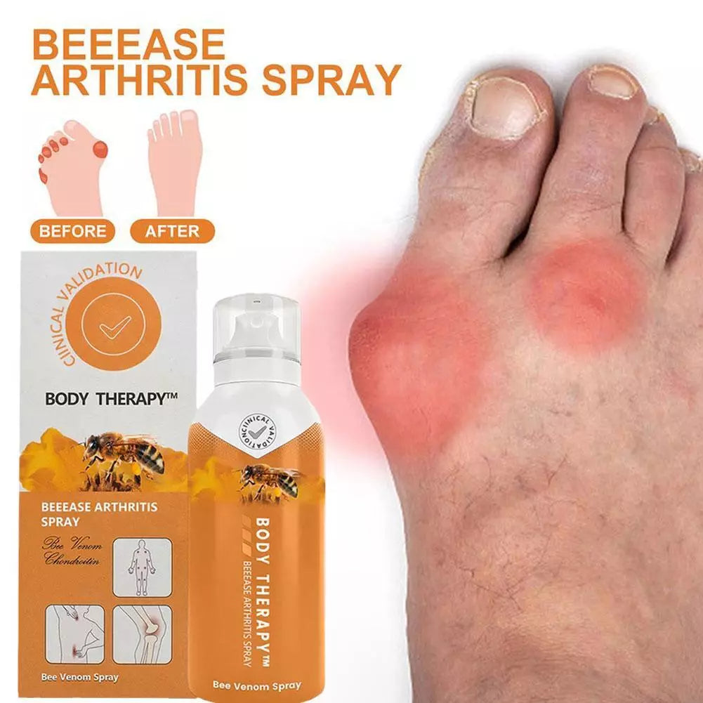 Gout treatment spray